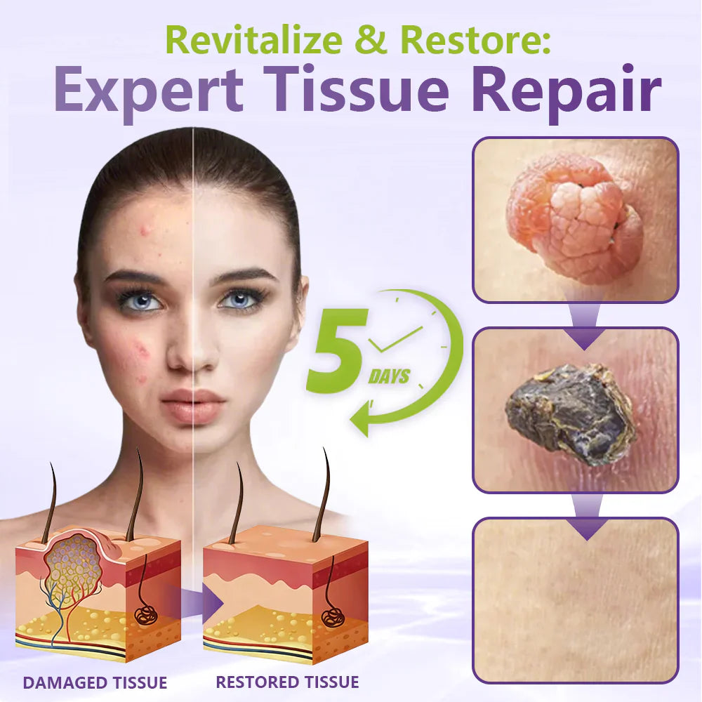 MicroNeedle Botanic Skin Tag Removal Patch