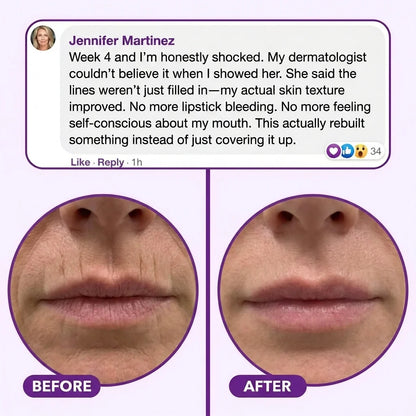 The Rebuild Stick: The Korean Beauty Secret to Erasing Vertical Lip Lines