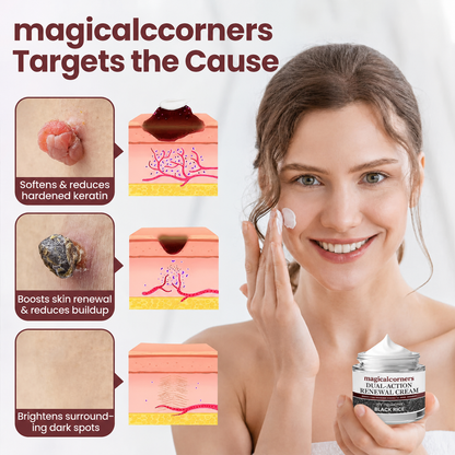 magicalccorners® KeraErase Dual-Action Renewal Cream