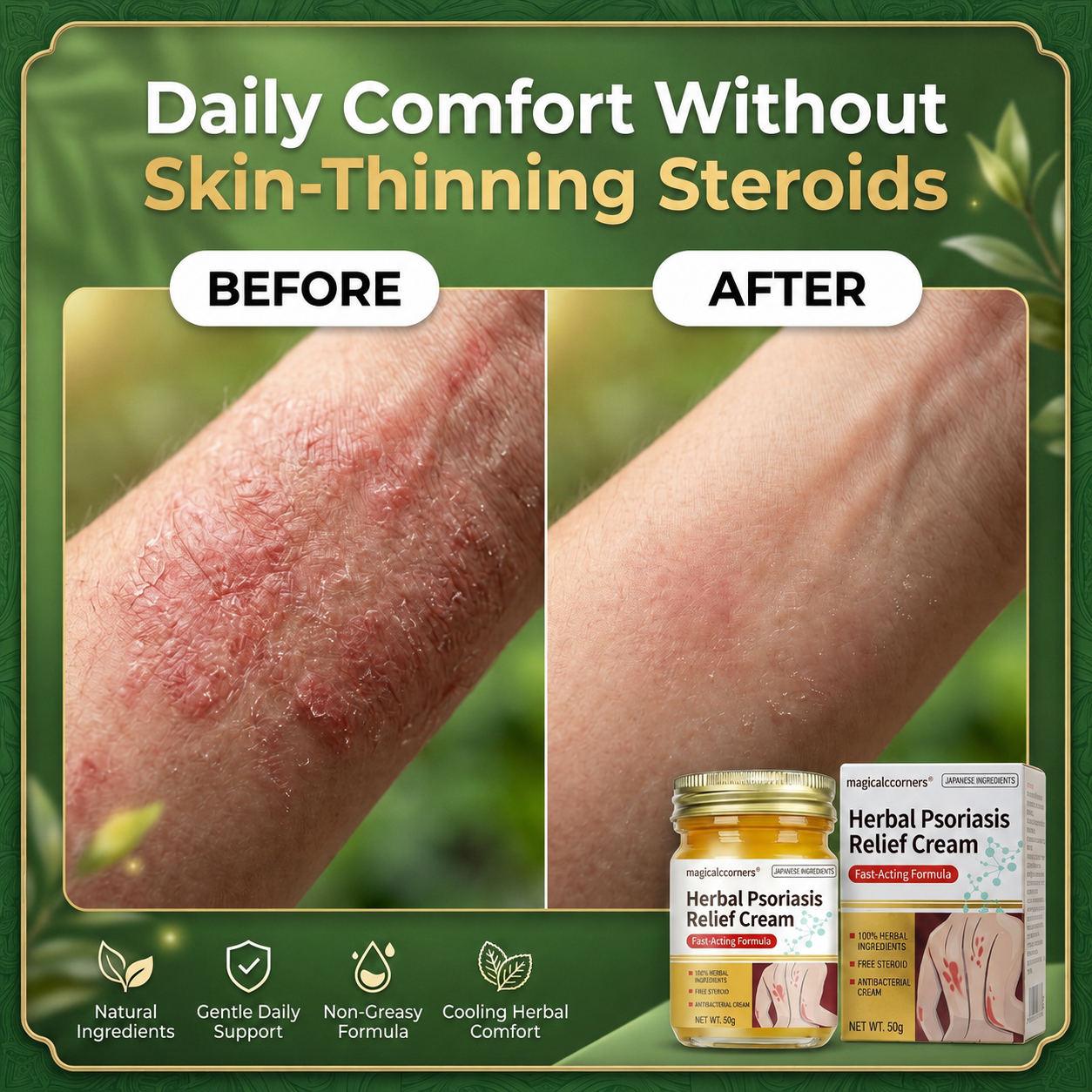 Herbal Psoriasis & Eczema Relief Skin Cream