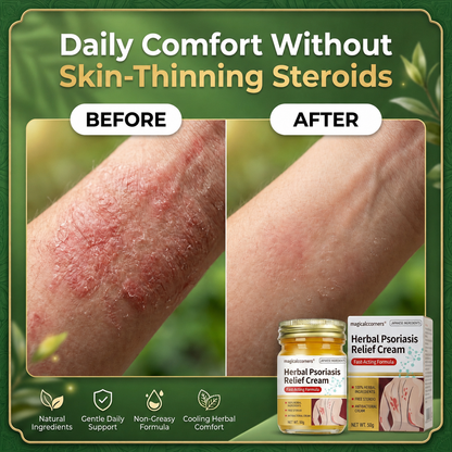 Herbal Psoriasis & Eczema Relief Skin Cream
