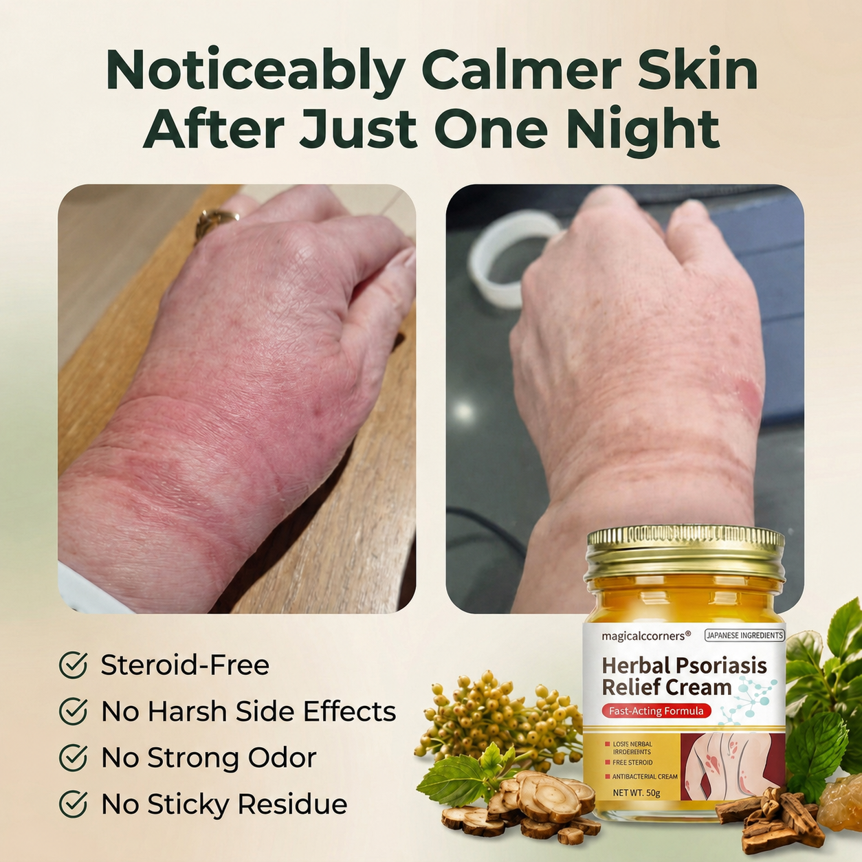 Herbal Psoriasis & Eczema Relief Skin Cream