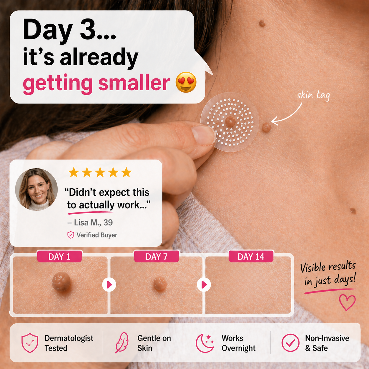 MicroNeedle Botanic Skin Tag Removal Patch