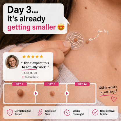MicroNeedle Botanic Skin Tag Removal Patch