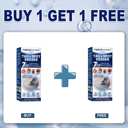 🎁One last chance! Grab this lucky find at 92% OFF!Magicalccorners®
