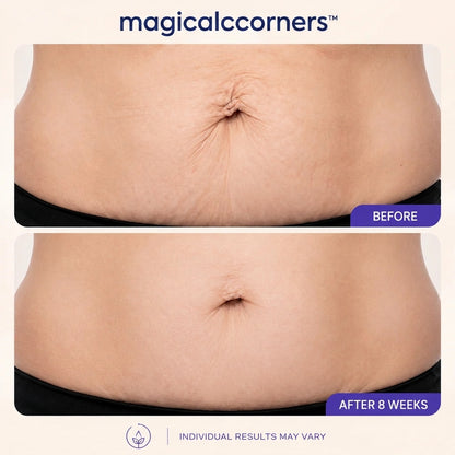 magicalccorners™ Tighten & Smooth Belly Cream